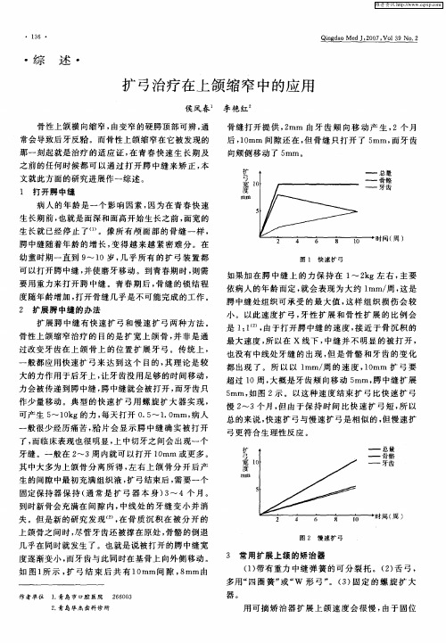 扩弓治疗在上颌缩窄中的应用