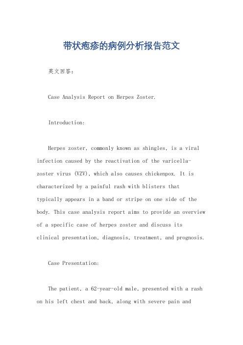 带状疱疹的病例分析报告范文