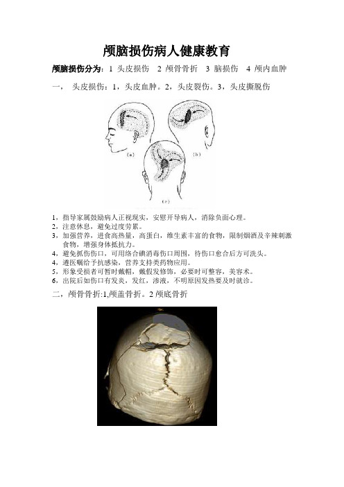          颅脑损伤病人健康教育