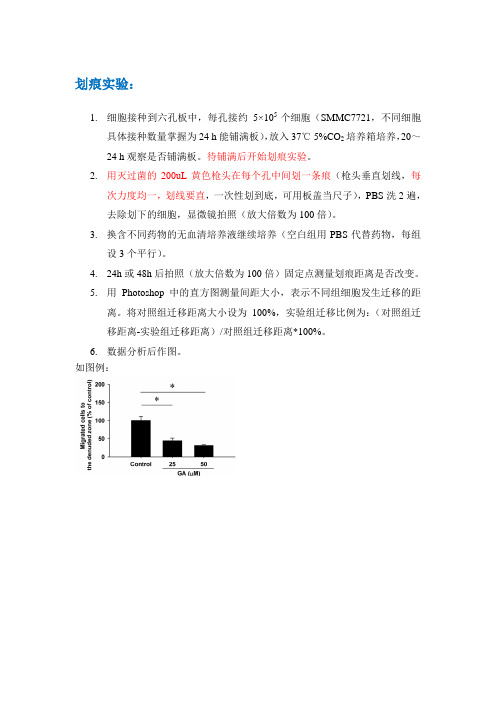 划痕及Transwell实验方法20130905