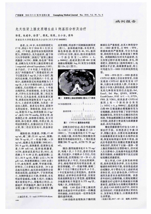 先天性肾上腺皮质增生症1例基因分析及治疗