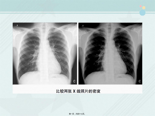 医学影像技术《X线照片质量及影响因素》