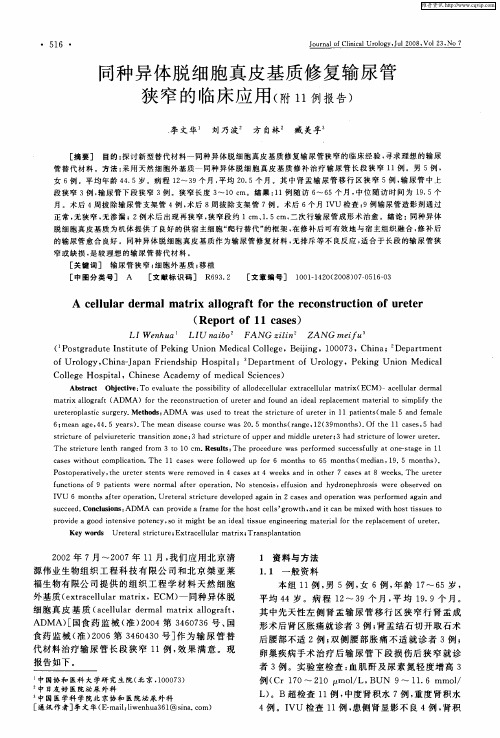 同种异体脱细胞真皮基质修复输尿管狭窄的临床应用(附11例报告)