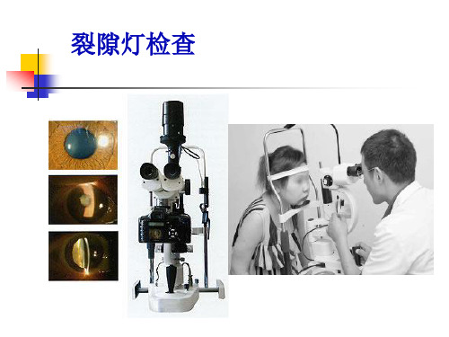 裂隙灯及直接检眼镜检查