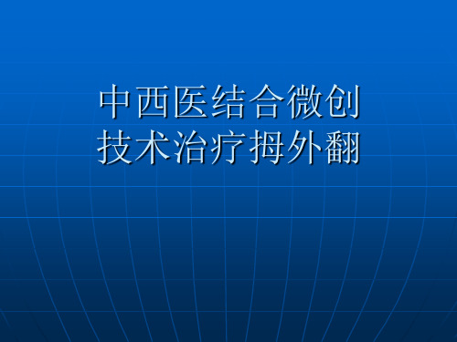 温建民中西医结合微创技术治疗拇外翻