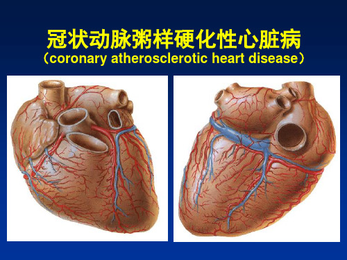 冠心病