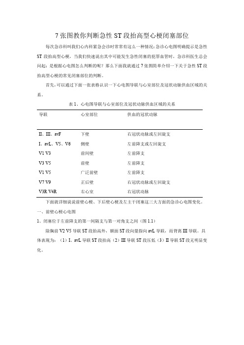 7张图教你急性ST段抬高型心梗闭塞部位判断