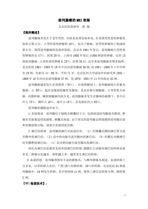 CT陈敏前列腺癌MRI诊断