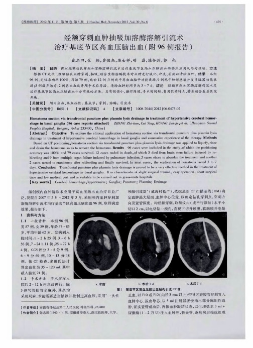 经额穿刺血肿抽吸加溶酶溶解引流术治疗基底节区高血压脑出血(附96例报告)