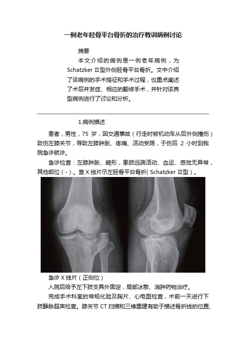 一例老年胫骨平台骨折的治疗教训病例讨论