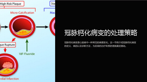 冠脉钙化病变的处理策略