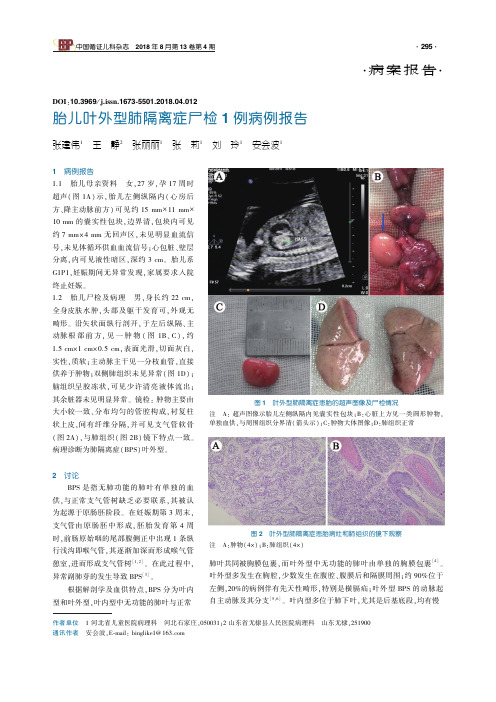 胎儿叶外型肺隔离症尸检1例病例报告