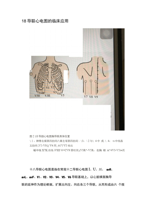 心电图18导联