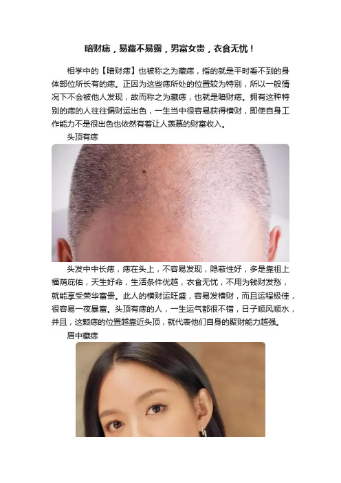 暗财痣，易藏不易露，男富女贵，衣食无忧！