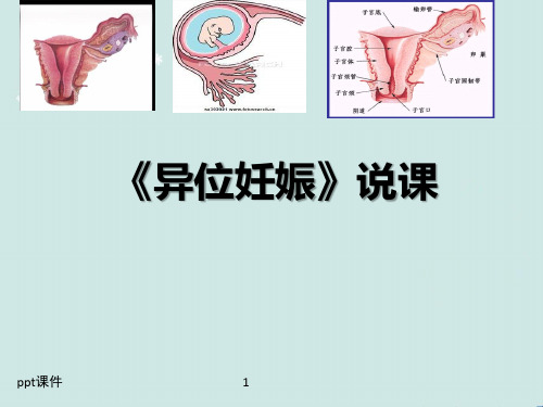 《异位妊娠》说课  ppt课件