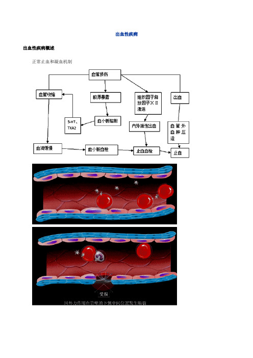 医学临床讲义资料-出血性疾病--图文解说