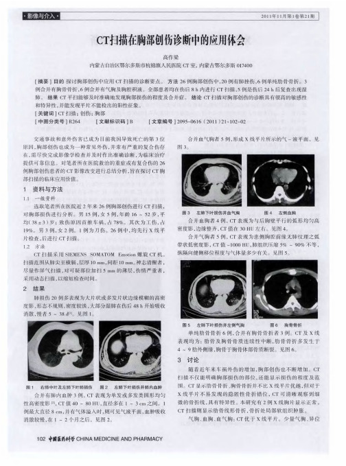 CT扫描在胸部创伤诊断中的应用体会