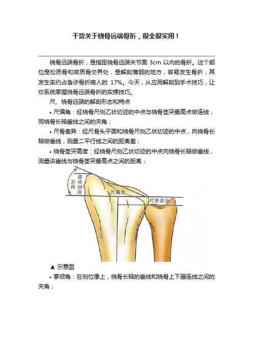 干货关于桡骨远端骨折，很全很实用！