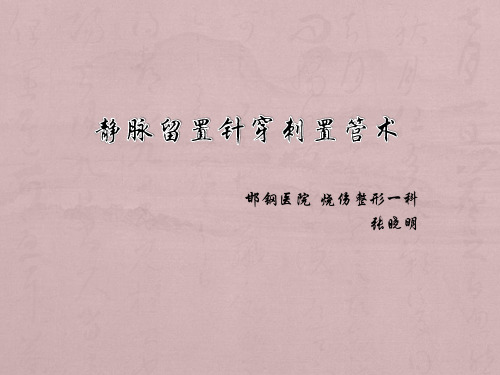 静脉留置针穿刺置管