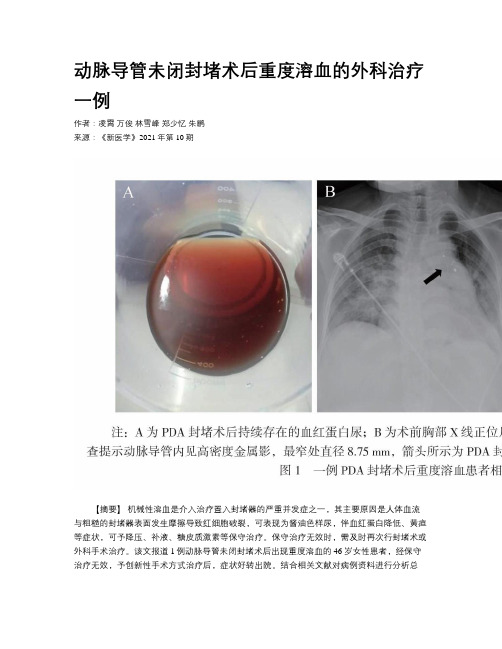 动脉导管未闭封堵术后重度溶血的外科治疗一例