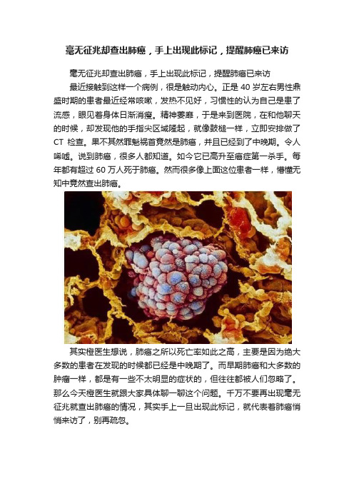 毫无征兆却查出肺癌，手上出现此标记，提醒肺癌已来访