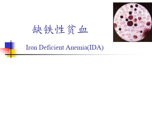 内科学课件：缺铁性贫血