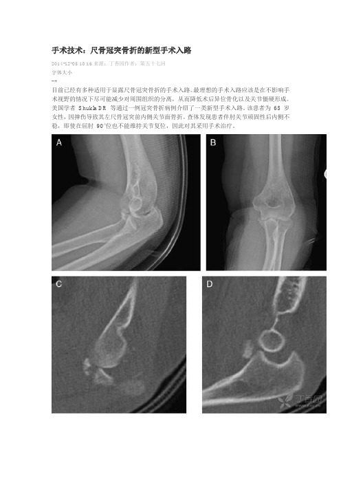 尺骨冠突骨折新型手术入路资料