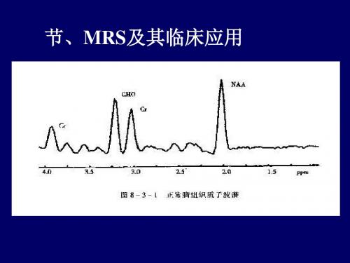 MRS及其临床应用