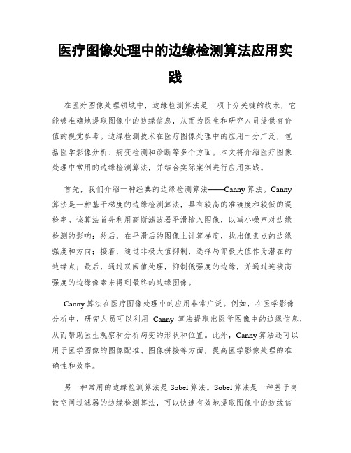 医疗图像处理中的边缘检测算法应用实践