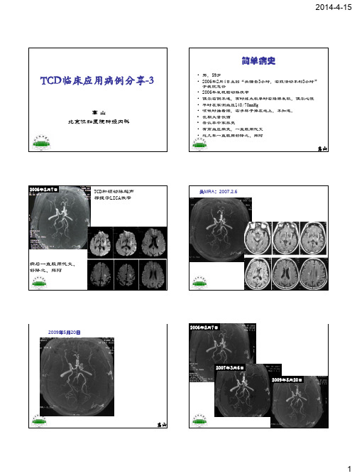 TCD临床应用病例分享-3