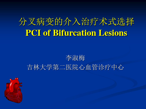 分叉病变的介入治疗术式选择PCIofBifurcationLesions教学课件