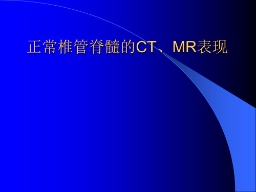 医学影像学课件：正常椎管脊髓的CT、MR表现