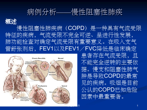 《病例分析》PPT课件