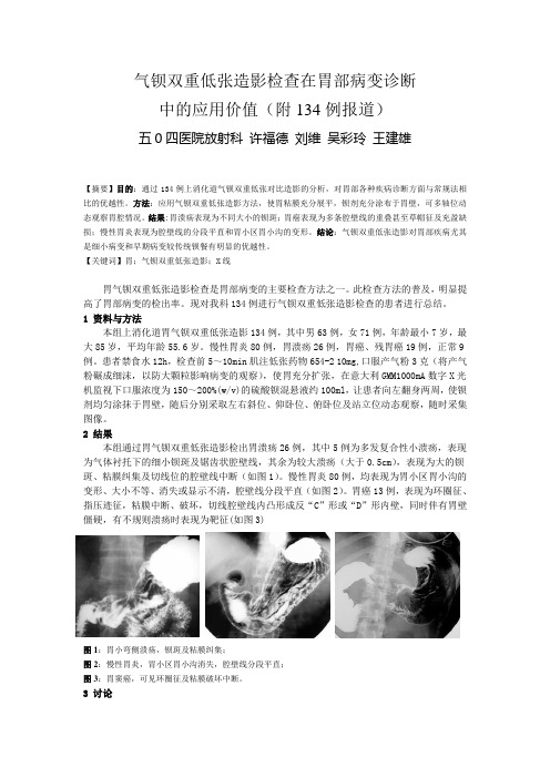 气钡双重低张造影检查在胃部病变诊断