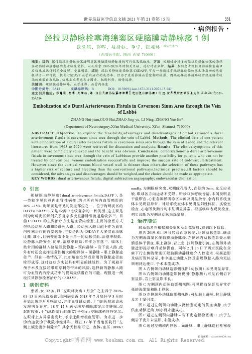 经拉贝静脉栓塞海绵窦区硬脑膜动静脉瘘1 例 