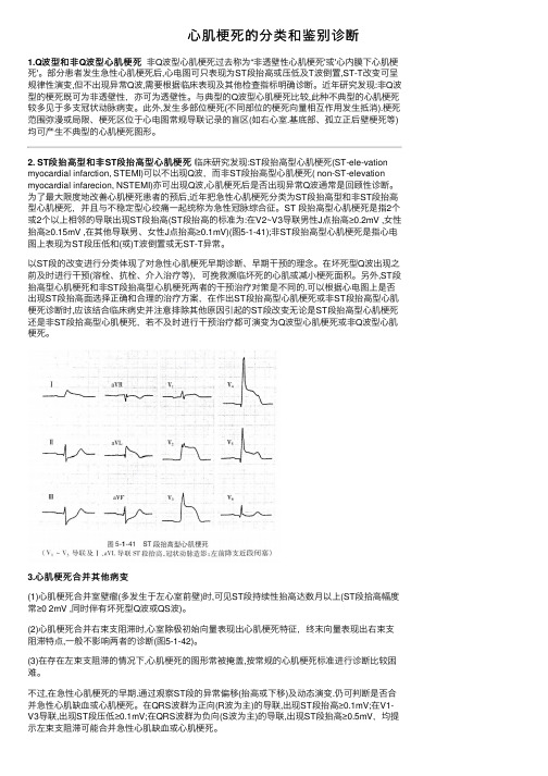 心肌梗死的分类和鉴别诊断