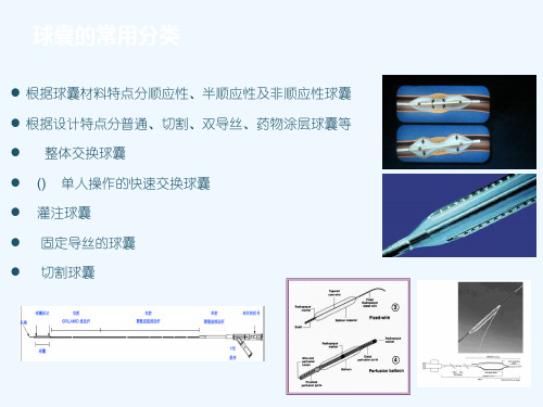 介入治疗中球囊作用及进展