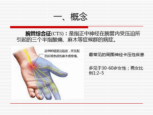 腕管综合征的诊断