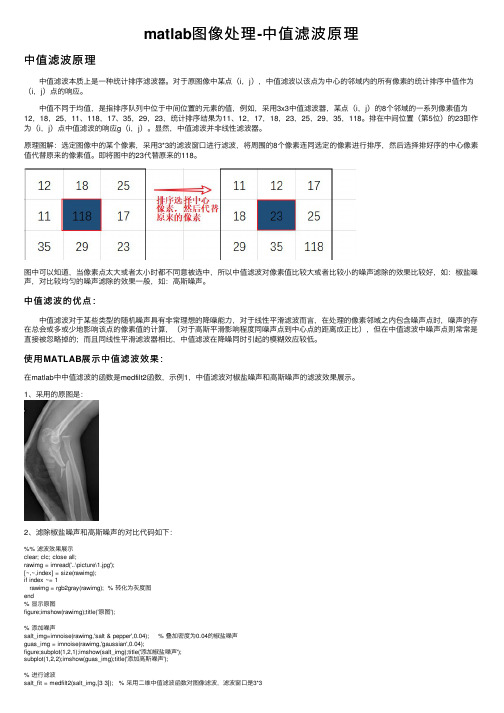 matlab图像处理-中值滤波原理