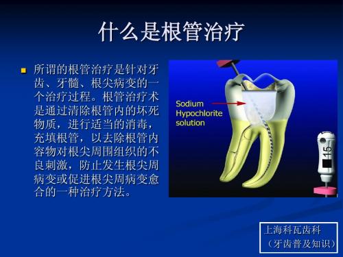 什么是根管治疗