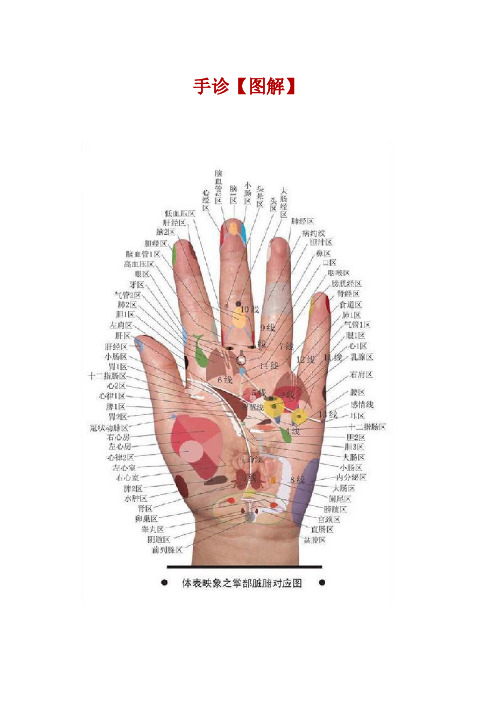 手诊[图解]