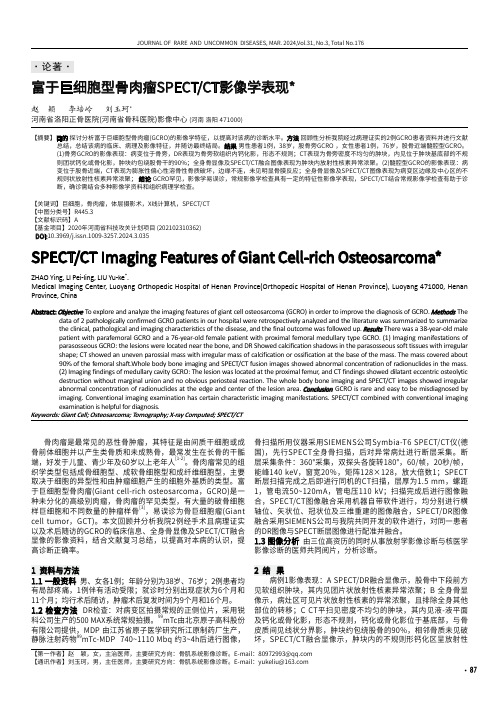 富于巨细胞型骨肉瘤SPECT