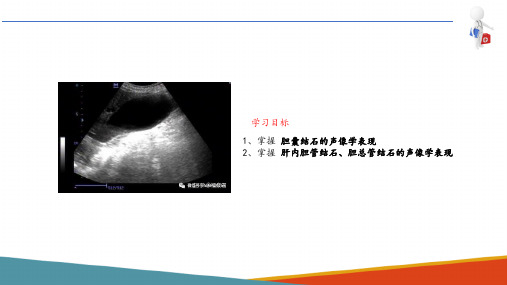 胆囊和胆管超声检查 胆管疾病超声诊断