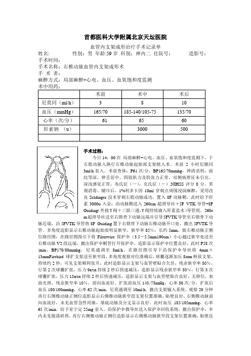 右椎动脉血管内支架成形术手术记录