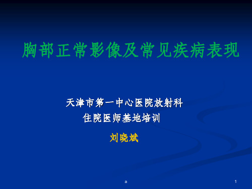 胸部正常影像及常见疾病表现最终版