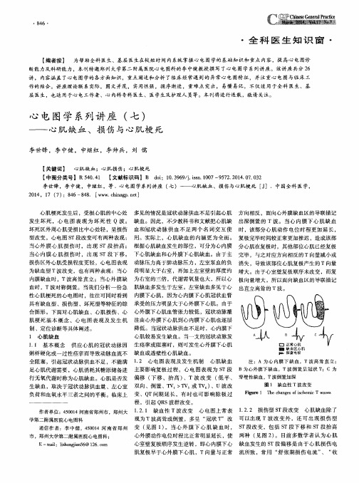 心电图学系列讲座(七)——心肌缺血、损伤与心肌梗死