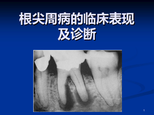 根尖周病的临床表现及诊断