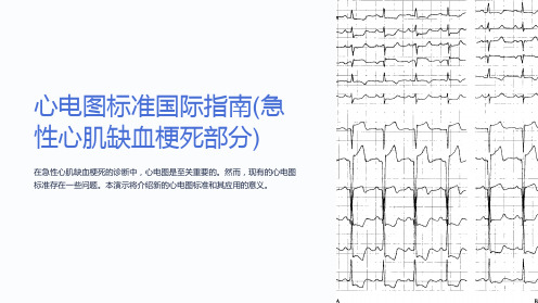 心电图标准国际指南(急性心肌缺血梗死部分)