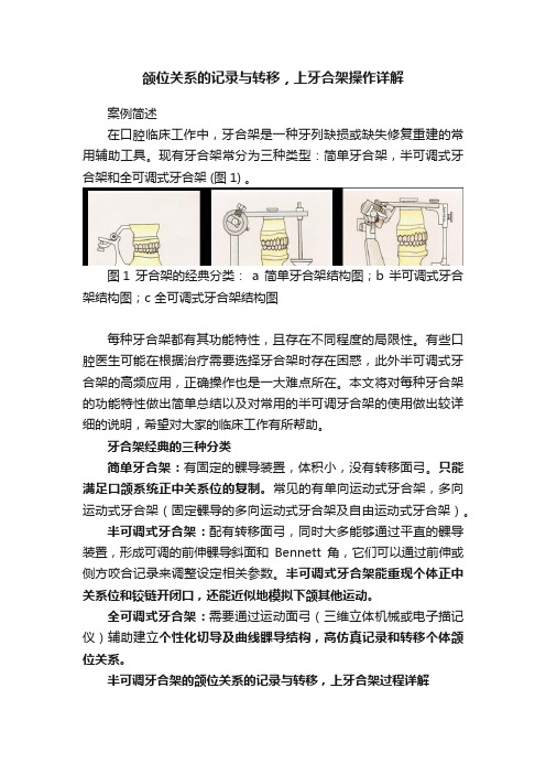 颌位关系的记录与转移，上牙合架操作详解