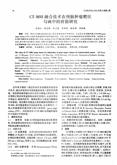 CT—MRI融合技术在颅脑肿瘤靶区勾画中的价值研究